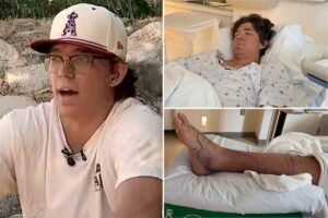 Read more about the article Baseball standout runs hospital dry of anti-venom after rattlesnake bite in desperate fight
