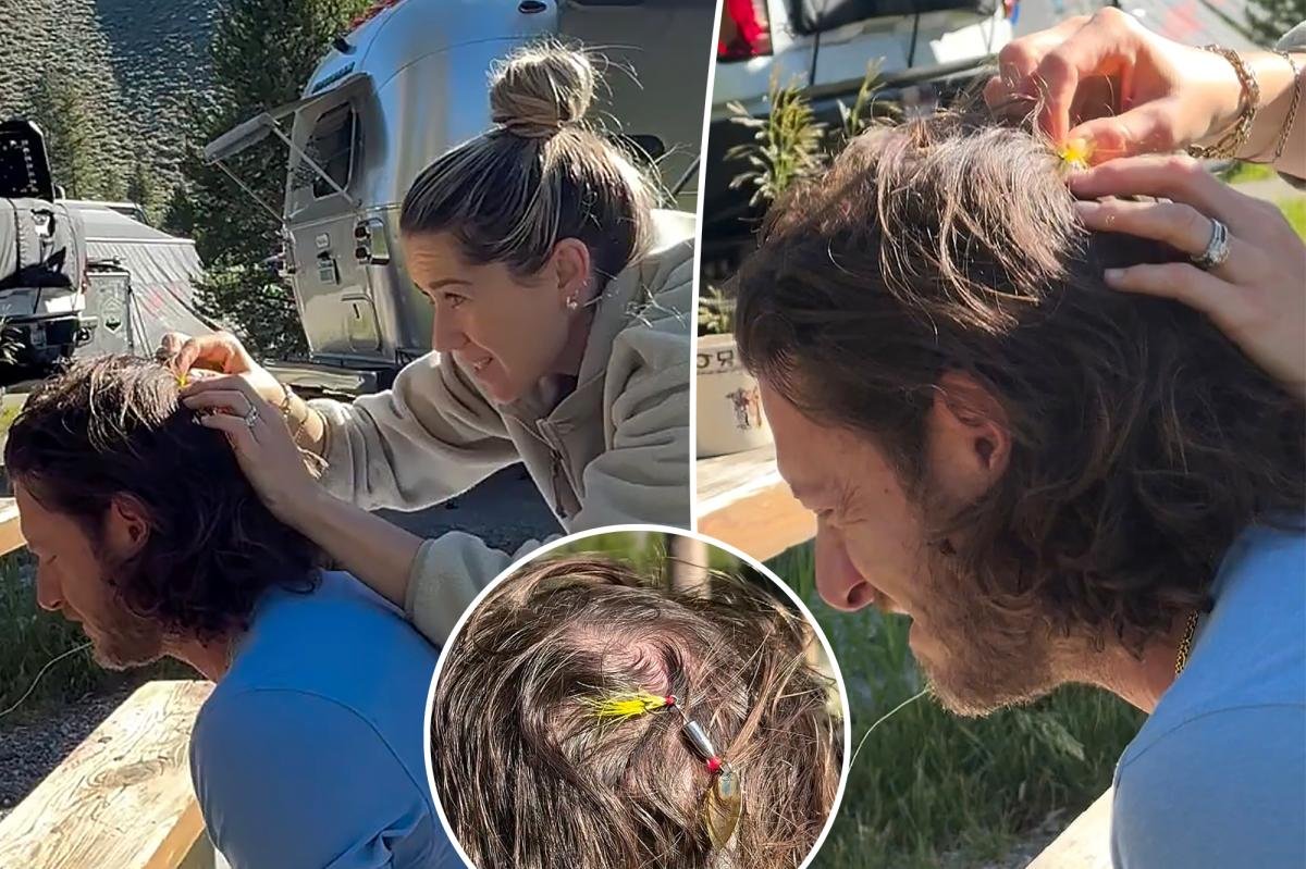 You are currently viewing Florida Georgia Line’s Tyler Hubbard gets fish hook stuck in head in wild camping accident