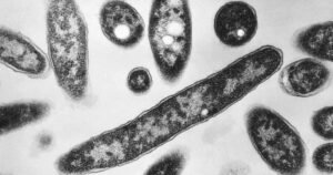 Read more about the article Second death reported in Legionnaires’ disease outbreak in New York City