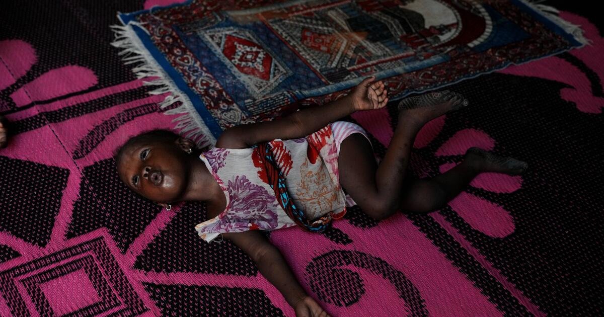 Read more about the article Another effect of the Iran war: Nigerian children suffer as malnutrition and poverty surge