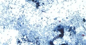 Read more about the article Outbreak of diarrhea-causing parasite grows to more than 1,000 cases