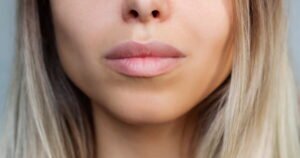 Read more about the article In pursuit of ‘Instagram face,’ are we losing the imperfections that make us human?