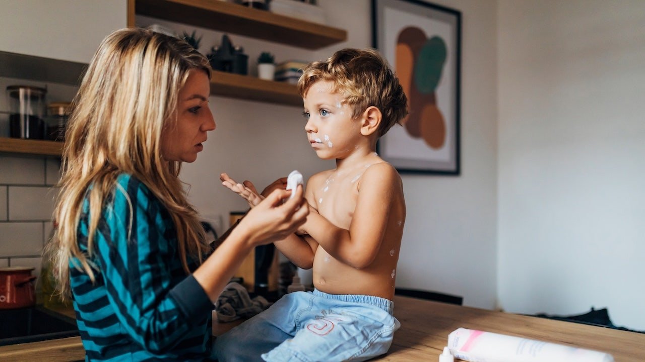 You are currently viewing Measles cases across US top 2,000, surpassing last year’s numbers
