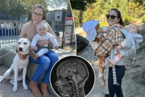 Read more about the article Doctors told me I had anxiety â I was relieved to finally get diagnosed with a brain tumor