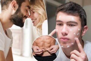 Read more about the article Men are taking shortcuts with a drug that âkills your spermâ â and can cause acne and breast growth, warns doc