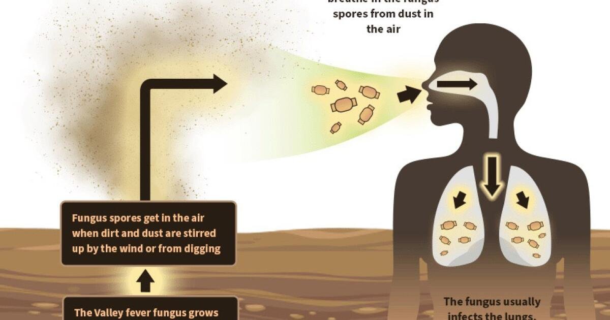 Read more about the article New drug could help people stricken with Valley Fever