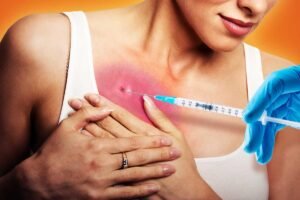 Read more about the article I got a boob job from a dead person’s fat — and it ruined my breasts forever