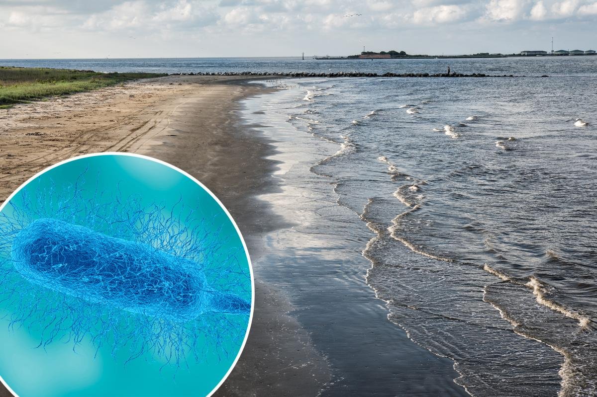 You are currently viewing What is Vibrio vulnificus? Deadly flesh-eating bacteria infections surge in South