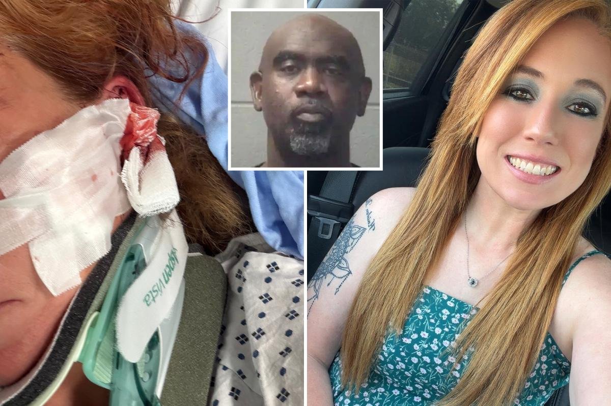 You are currently viewing DoorDash mom left with skull fractures, brain bleeds after man allegedly follows her and attacks with bat