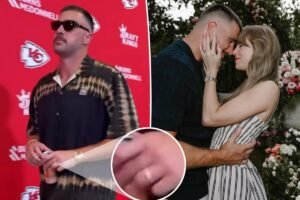 Read more about the article Travis Kelce proudly shows off wedding band ahead of first Chiefs game since wedding to Taylor Swift