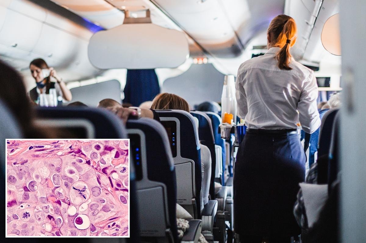 Read more about the article Flight attendants, pilots have highest risk of dying from radiation-linked cancers, study says