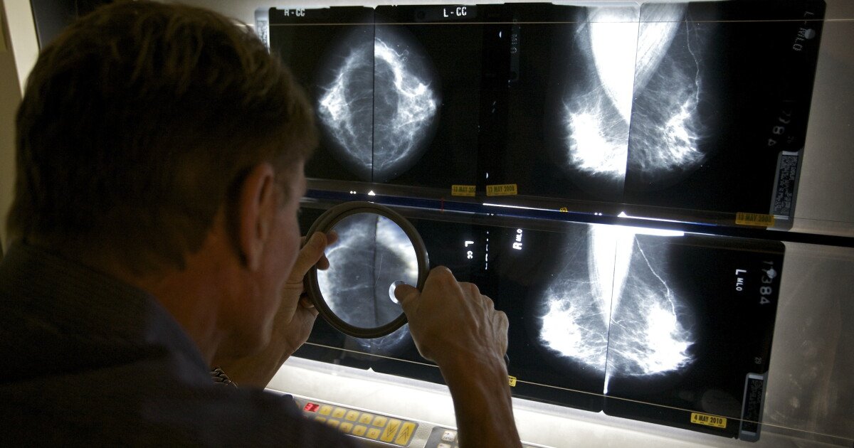 You are currently viewing Cancer survey raises questions about Medi-Cal work requirements for people with serious illnesses