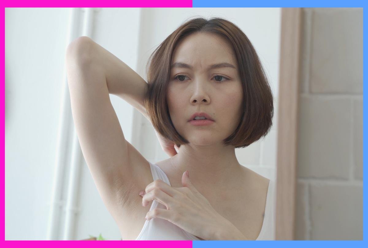 You are currently viewing The weirdest and grossest places to get acne â and how you should treat them, per a derm
