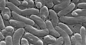 Read more about the article Flesh-eating bacteria cases prompt health warnings for Gulf Coast beachgoers