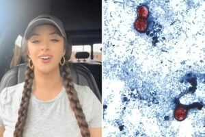 Read more about the article TikTok food critic, 29, details âmiserableâ experience of contracting âexplosive diarrheaâ parasite