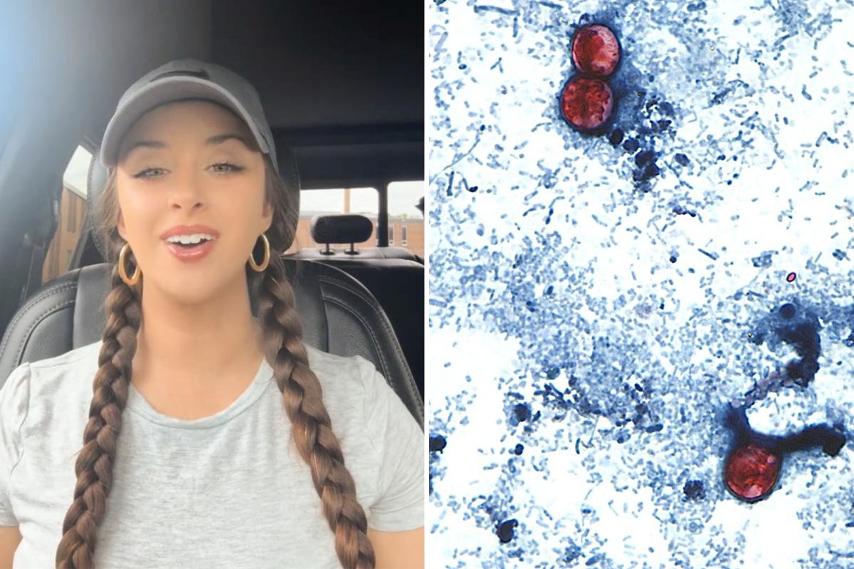 You are currently viewing TikTok food critic, 29, details âmiserableâ experience of contracting âexplosive diarrheaâ parasite