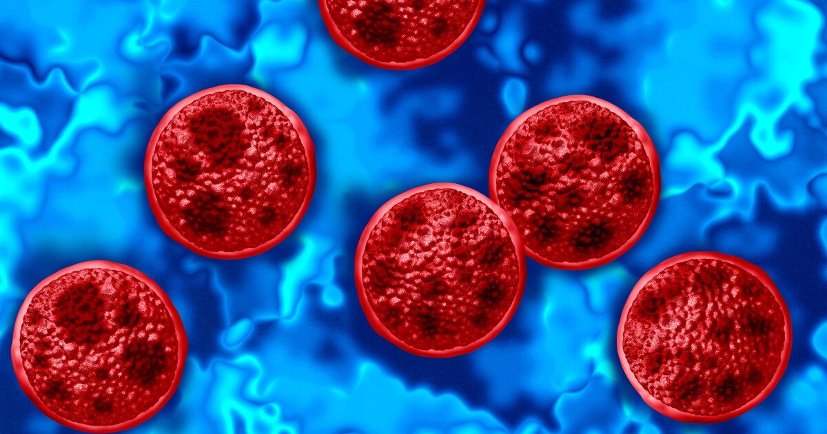 You are currently viewing Two people in Michigan have died after becoming ill with cyclosporiasis