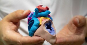 Read more about the article This 3D lab is changing how surgeons save lives at Rady Children’s