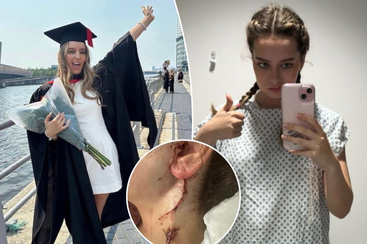 Read more about the article College student unable to move half of her face after emergency surgery to remove rare cancer