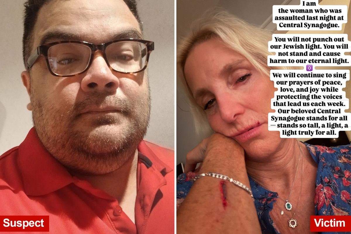 You are currently viewing NYC synagogue attack victim punches back at unhinged attacker: ‘We will continue to sing’